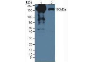 Western blot analysis of (1) Human Serum and (2) Human Lung Tissue. (PZP antibody  (AA 1212-1391))