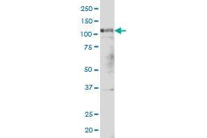 PTK2 monoclonal antibody (M02), clone 1C1 Western Blot analysis of PTK2 expression in Hela S3 NE . (FAK antibody  (AA 355-490))