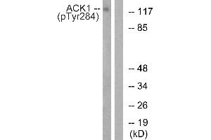 Western blot analysis of extracts from HepG2 cells, treated with EGF (200 ng/mL, 30 mins), using ACK1 (Phospho-Tyr284) antibody. (TNK2 antibody  (pTyr284))