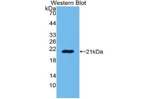 Western blot analysis of the recombinant protein. (POTEG antibody  (AA 177-330))