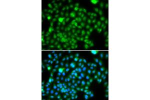 Immunofluorescence analysis of A549 cell using N6AMT1 antibody.