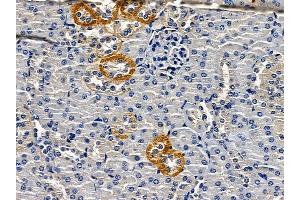 ABIN6262753 and ABIN6279177 at 1/100 staining mouse kidney tissue by IHC-P. (KCNJ8 antibody)