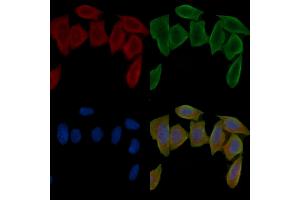 ABIN6261825 and ABIN6276547 staining Hela cells(30 min of UV treatment) by IF/ICC.