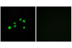 Immunofluorescence (IF) image for anti-Collagen, Type XXIII, alpha 1 (COL23A1) (C-Term) antibody (ABIN1850316) (COL23A1 antibody  (C-Term))