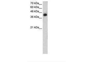 Image no. 1 for anti-Microtubule Associated Tumor Suppressor 1 (MTUS1) (AA 90-139) antibody (ABIN205046) (MTUS1 antibody  (AA 90-139))