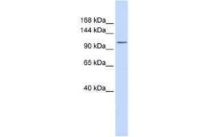 ATP2B3 antibody used at 1 ug/ml to detect target protein. (ATP2B3 antibody  (N-Term))