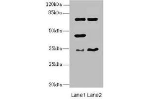 Western blot All lanes: EHF antibody at 4. (EHF antibody  (AA 1-210))