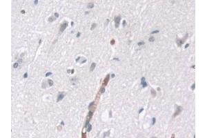 Detection of tPK1 in Human Cerebrum Tissue using Polyclonal Antibody to Tau-Protein Kinase 1 (tPK1) (TPK1 antibody  (AA 34-300))