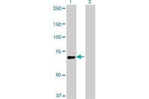 Western Blot analysis of SLC9A6 expression in transfected 293T cell line by SLC9A6 monoclonal antibody (M02), clone 2D5. (SLC9A6 antibody  (AA 602-669))