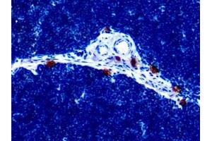 Detection of IL18 in Rat Thymus Tissue using Monoclonal Antibody to Interleukin 18 (IL18) (IL-18 antibody  (AA 37-194))