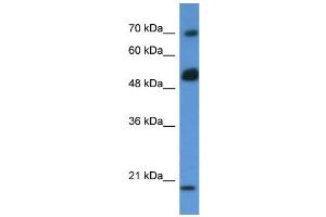 Western Blotting (WB) image for anti-rho GTPase Activating Protein 36 (ARHGAP36) (N-Term) antibody (ABIN406257) (ARHGAP36 antibody  (N-Term))