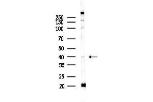 Western blot analysis of lysates from COLO205 cells(UV,30 min treatment), using USF2 Antibody at 1/1000 dilution.