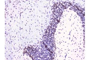 IHC analysis of RbAp48 using anti-RbAp48 antibody (ABIN5692929).