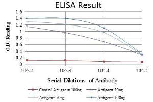 Red: Control Antigen (100 ng), Purple: Antigen (10 ng), Green: Antigen (50 ng), Blue: Antigen (100 ng), (SMN1 antibody)