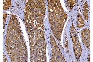 IHC analysis of Cdk2 using anti-Cdk2 antibody (ABIN7602523). (CDK2 antibody  (AA 81-298))