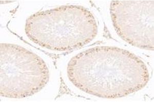 IL28B antibody