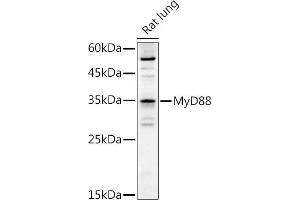 Western blot analysis of extracts of Rat lung, using MyD88 antibody (ABIN6128257, ABIN6144228, ABIN6144229 and ABIN6213986) at 1:1000 dilution. (MYD88 antibody  (AA 60-309))