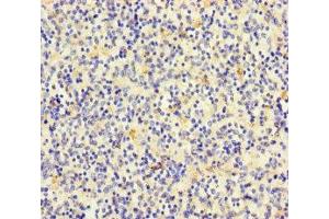 Immunohistochemistry of paraffin-embedded human spleen tissue using ABIN7171488 at dilution of 1:100 (TLN2 antibody  (AA 88-406))