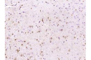 Paraformaldehyde-fixed, paraffin embedded mouse brain; Antigen retrieval by boiling in sodium citrate buffer (pH6) for 15min; Block endogenous peroxidase by 3% hydrogen peroxide for 30 minutes; Blocking buffer (normal goat serum) at 37°C for 20min; Antibody incubation with APBA1 Polyclonal Antibody, Unconjugated (bs-11334R)at 1:200 overnight at 4°C, followed by a conjugated secondary and DAB staining. (APBA1 antibody  (AA 451-550))