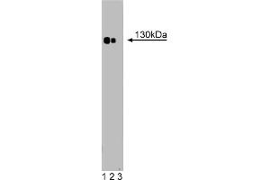 Western Blotting (WB) image for anti-Phospholipase C beta 4 (PLCb4) (AA 752-961) antibody (ABIN968583) (Phospholipase C beta 4 antibody  (AA 752-961))