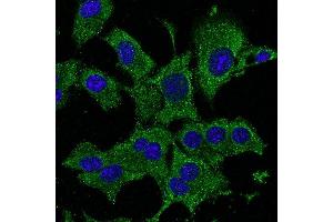 Immunofluorescence - anti-ATG12 Ab - Autophagosome Marker in Hepa1-6 cells at 1/50 dilution, cells were fixed With methanol, (ATG12 antibody  (N-Term))