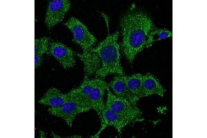 Immunofluorescence - anti-ATG12 Ab - Autophagosome Marker in Hepa1-6 cells at 1/50 dilution, cells were fixed With methanol,