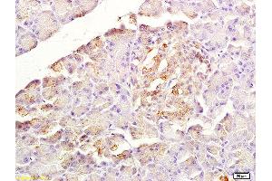 Formalin-fixed and paraffin embedded rat pancreas labeled with Anti-SDF-1/CXCL12 Polyclonal Antibody, Unconjugated (ABIN1386329) at 1:200 followed by conjugation to the secondary antibody and DAB staining (CXCL12 antibody  (AA 24-70))