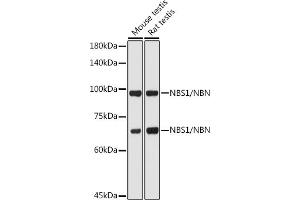 Western blot analysis of extracts of various cell lines, using NBS1/NBS1/NBN antibody (ABIN1681204, ABIN3015326, ABIN3015327 and ABIN5663771) at 1:1000 dilution. (Nibrin antibody  (AA 435-754))