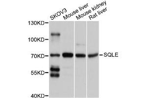 Western blot analysis of extracts of various cell lines, using SQLE antibody (ABIN4905291) at 1:1000 dilution. (SQLE antibody)