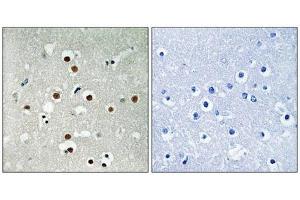 Immunohistochemical analysis of paraffin-embedded human brain tissue using MEF2C (Phospho-Ser396) antibody (left)or the same antibody preincubated with blocking peptide (right). (MEF2C antibody  (pSer396))