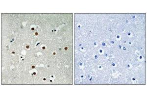 Immunohistochemical analysis of paraffin-embedded human brain tissue using MEF2C (Phospho-Ser396) antibody (left)or the same antibody preincubated with blocking peptide (right).