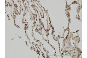 Immunoperoxidase of monoclonal antibody to NFKBIB on formalin-fixed paraffin-embedded human lung. (NFKBIB antibody  (AA 56-145))