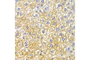 Immunohistochemistry of paraffin-embedded mouse liver using FASN antibody at dilution of 1:100 (400x lens). (Fatty Acid Synthase antibody)