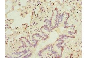 Immunohistochemistry of paraffin-embedded human lung tissue using ABIN7172635 at dilution of 1:100 (SOX5 antibody  (AA 1-120))