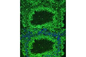 Immunofluorescence analysis of mouse testis cells using  antibody  at dilution of 1:100. (ASZ1 antibody  (AA 1-350))