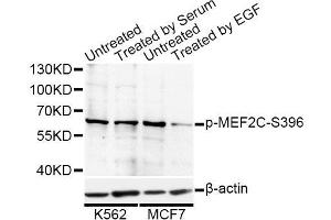 Western blot analysis of extracts of K-562 and MCF-7 cells, using Phospho-MEF2C-S396 antibody (ABIN5969920) at 1/1000 dilution. (MEF2C antibody  (pSer396))