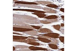 Immunohistochemical staining of human skeletal muscle with LOC653192 polyclonal antibody  shows strong cytoplasmic positivity in myocytes at 1:50-1:200 dilution. (TRIM43 antibody)