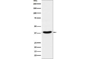 Western blot analysis of TRBP expression in Jurkat cell lysate.