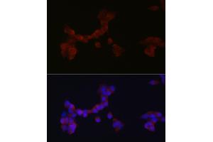 Immunofluorescence analysis of SH-SY5Y cells using D Rabbit pAb (ABIN6130320, ABIN6139385, ABIN6139386 and ABIN6214572) at dilution of 1:250 (40x lens). (DAB1 antibody  (AA 1-185))