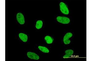 Immunofluorescence of monoclonal antibody to RAX on HeLa cell. (RAX antibody  (AA 104-206))