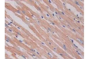 Detection of SIGIRR in Rat Heart Tissue using Polyclonal Antibody to Single Ig IL1 Related Receptor (SIGIRR) (SIGIRR antibody  (AA 1-118))