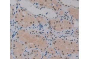 #VALUE! (JMJD6 antibody  (AA 1-334))