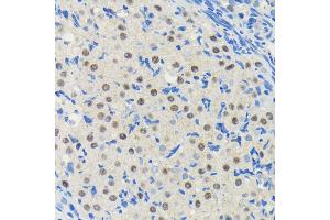 Immunohistochemistry of paraffin-embedded rat ovary using PIM1 antibody (ABIN7269375) at dilution of 1:100 (40x lens). (PIM1 antibody)