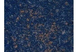 Detection of COL1a1 in Mouse Lymph node Tissue using Polyclonal Antibody to Collagen Type I Alpha 1 (COL1a1) (COL1A1 antibody  (AA 1225-1453))