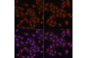 Immunofluorescence analysis of HeLa cells using MAP1LC3B antibody.