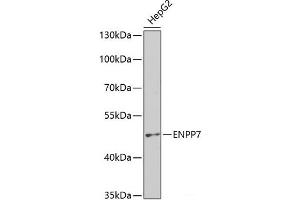 Western blot analysis of extracts of HepG2 cells using ENPP7 Polyclonal Antibody at dilution of 1:400. (ENPP7 antibody)