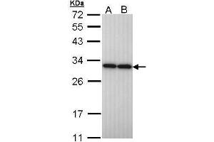 WB Image Sample (30 ug of whole cell lysate) A: H1299 B: Hela 12% SDS PAGE antibody diluted at 1:10000 (PGAM2 antibody)