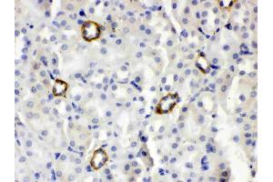 Immunohistochemistry (IHC) image for anti-ISG15 Ubiquitin-Like Modifier (ISG15) (AA 2-155) antibody (ABIN4886639)