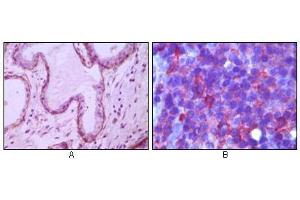 Immunohistochemical analysis of paraffin-embedded human breast ductal myoepithelium (A) and lymph tissue (B), showing cytoplasmic (A) and membrane (B) localization using CD10 antibody with DAB staining (A) and AEC staining (B). (MME antibody)