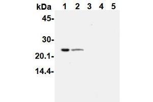 Western Blotting (WB) image for anti-PYD and CARD Domain Containing (PYCARD) antibody (ABIN1105662) (PYCARD antibody)